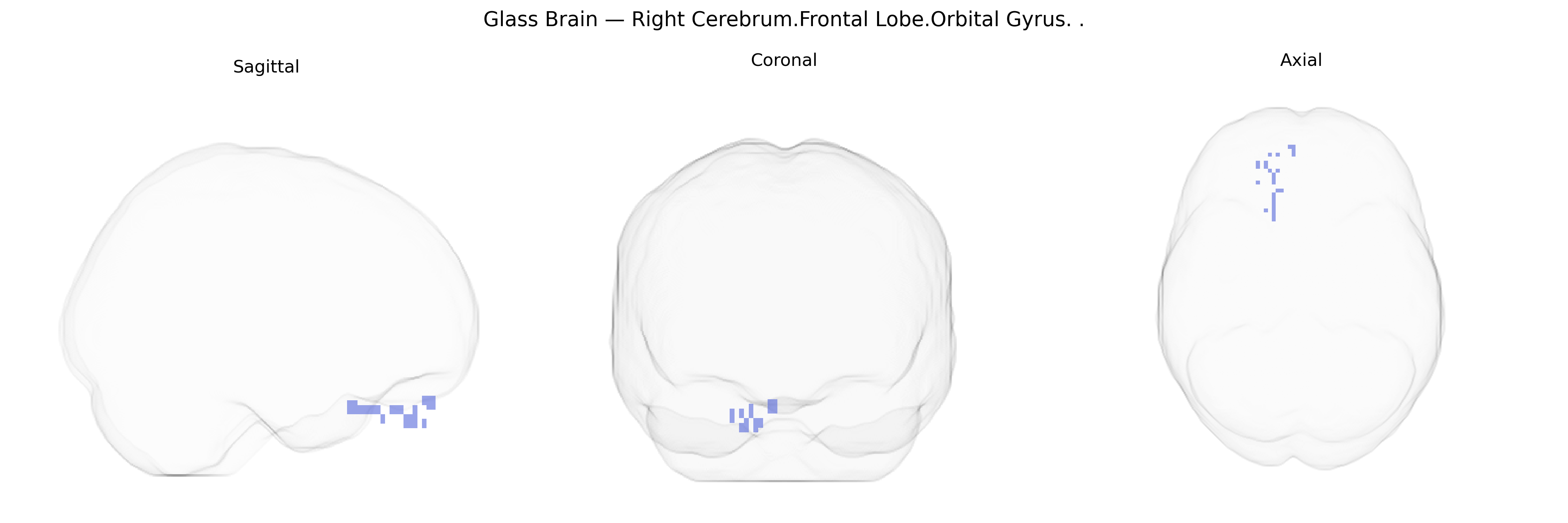 Triplanar Ghost Brain