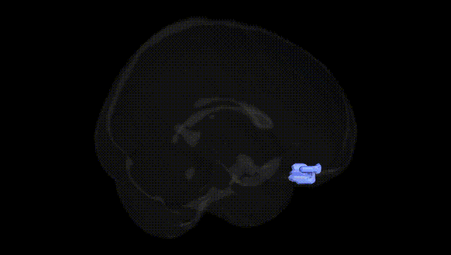 Full Brain Black