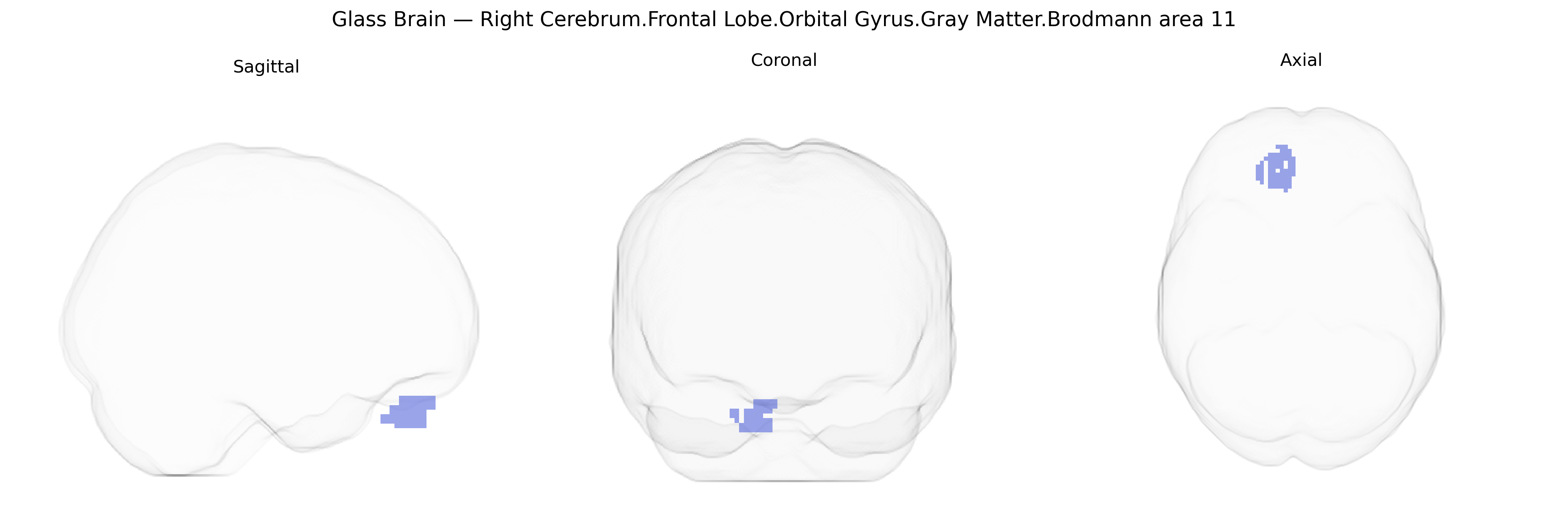 Triplanar Ghost Brain