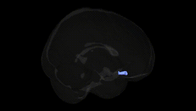 Full Brain Black