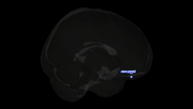 Full Brain Black