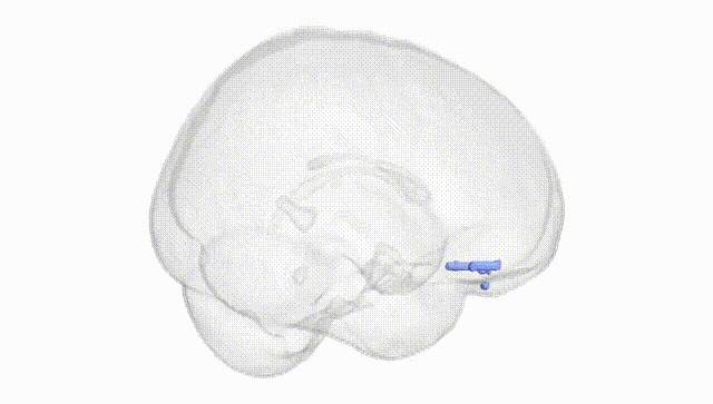 Full Brain White
