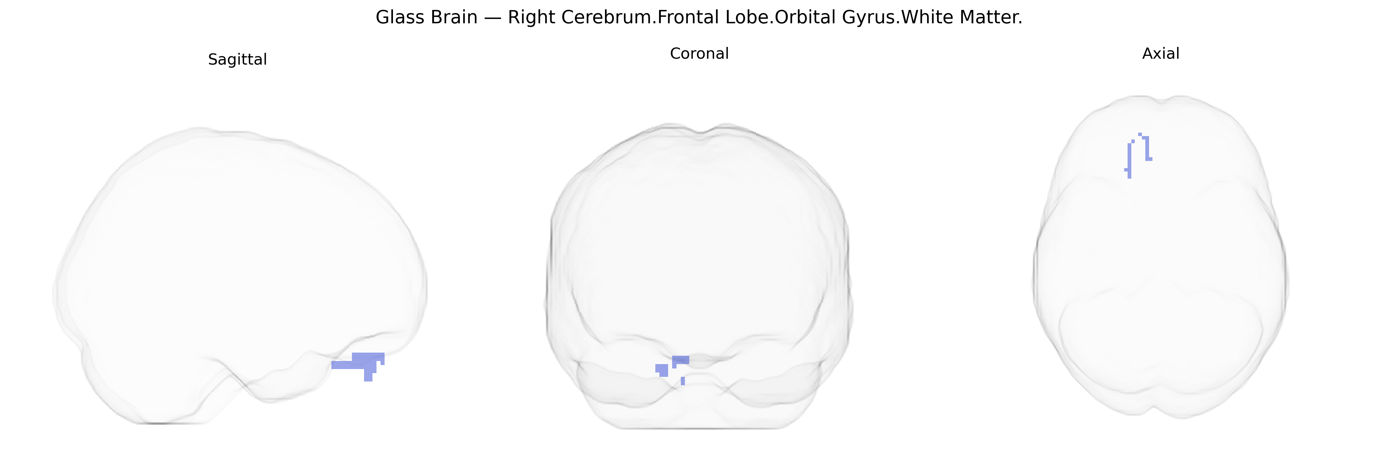 Triplanar Ghost Brain