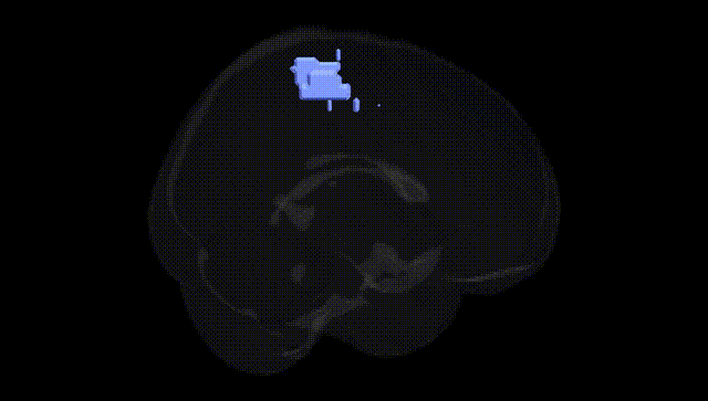 Full Brain Black