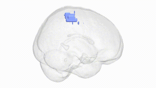 Full Brain White