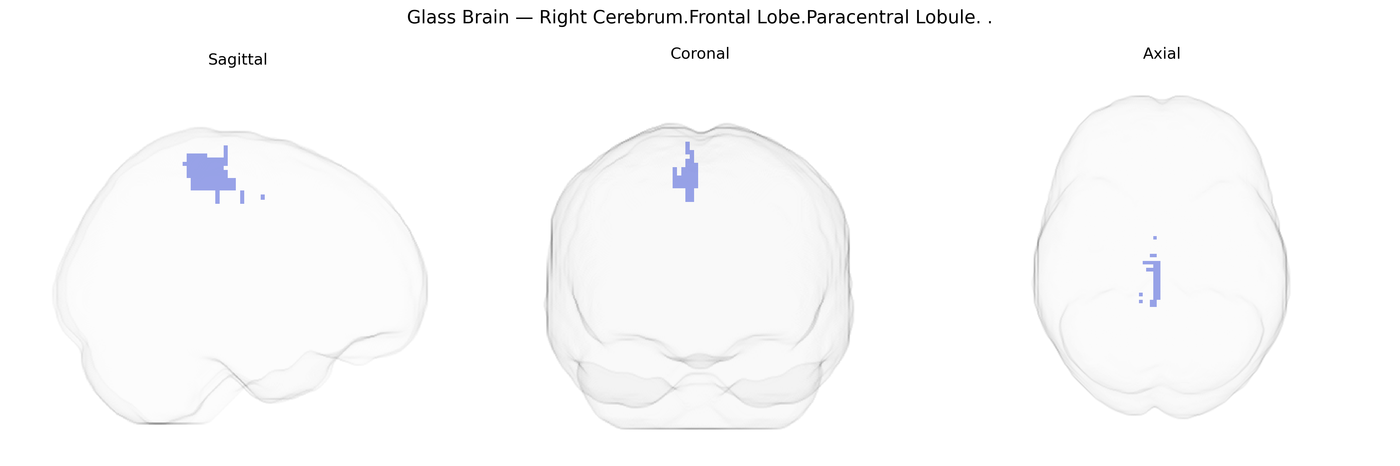 Triplanar Ghost Brain