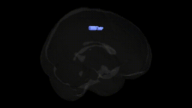 Full Brain Black