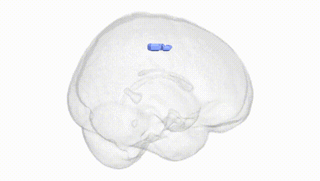Full Brain White