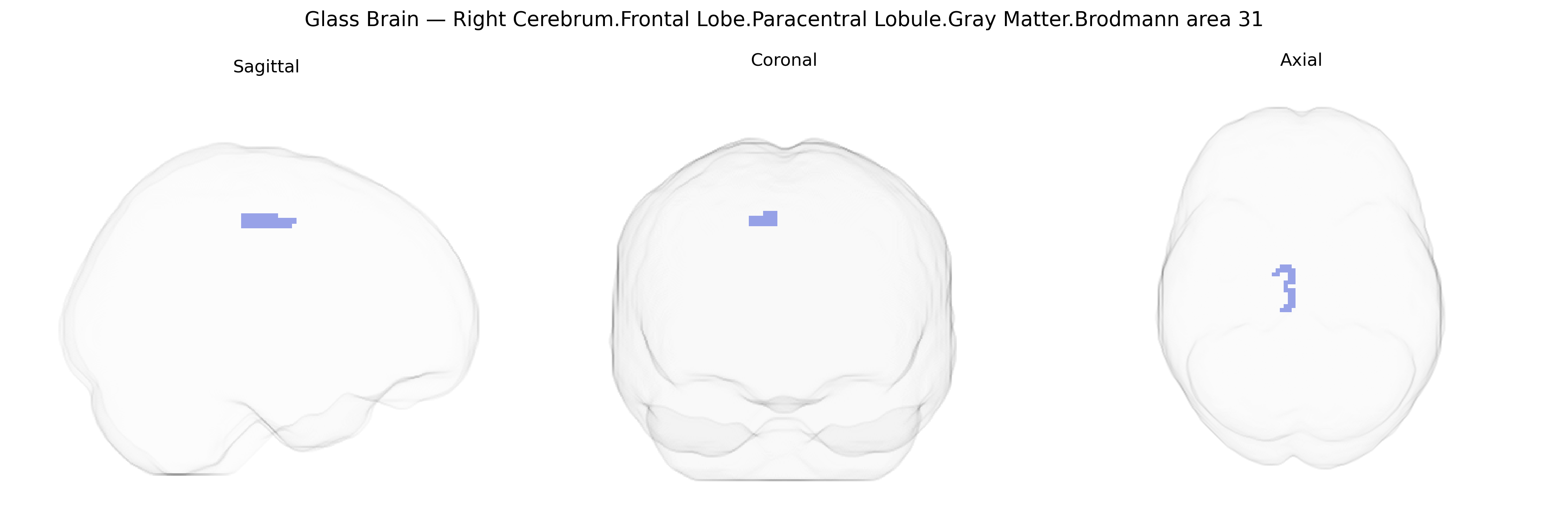 Triplanar Ghost Brain