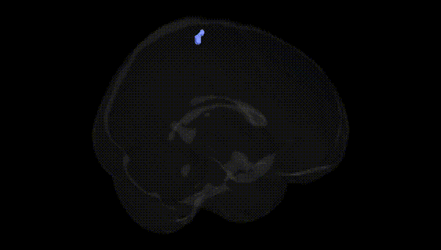 Full Brain Black