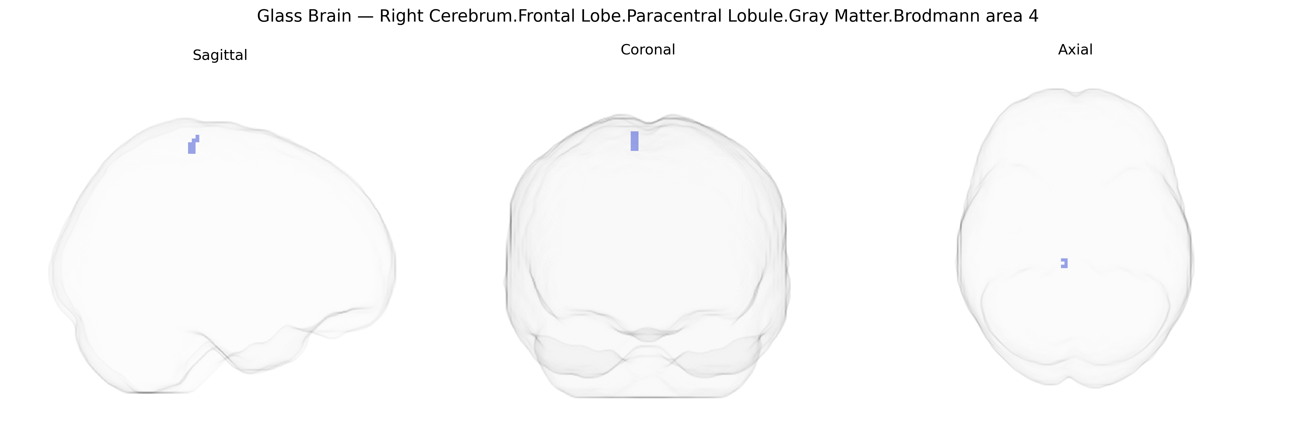 Triplanar Ghost Brain