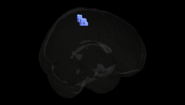 Full Brain Black