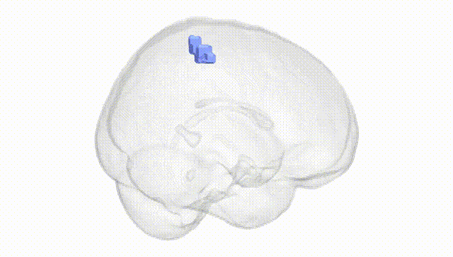 Full Brain White