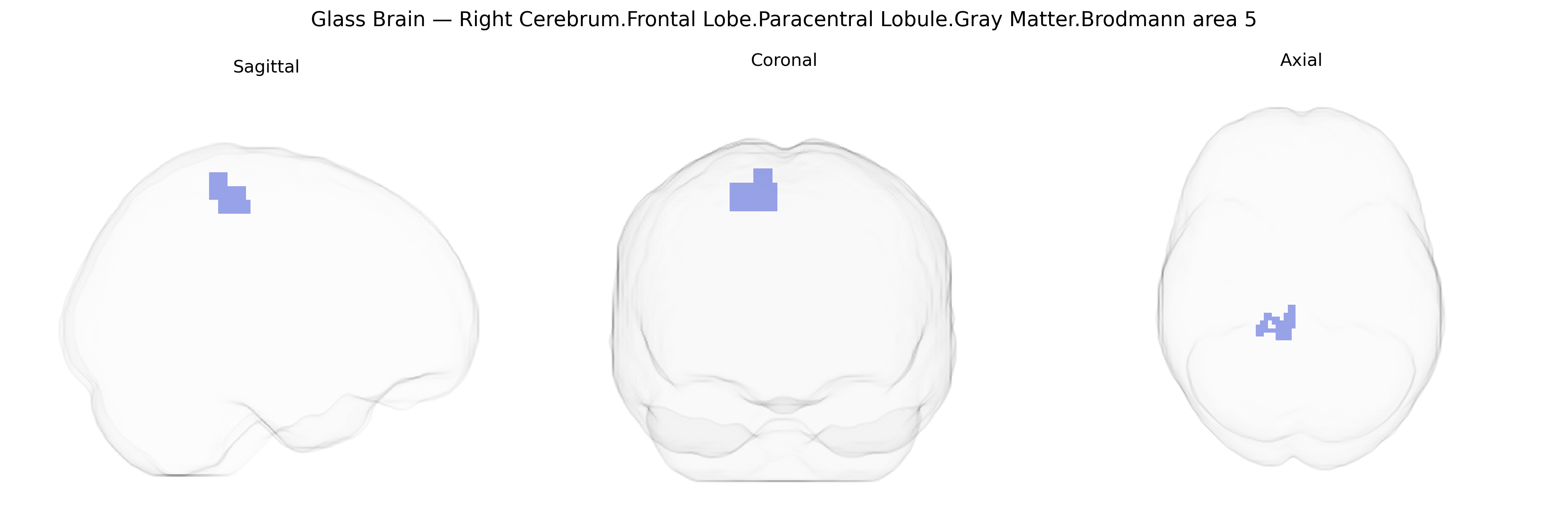 Triplanar Ghost Brain