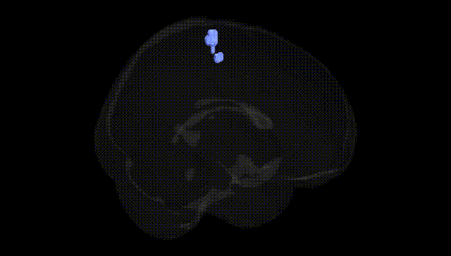 Full Brain Black