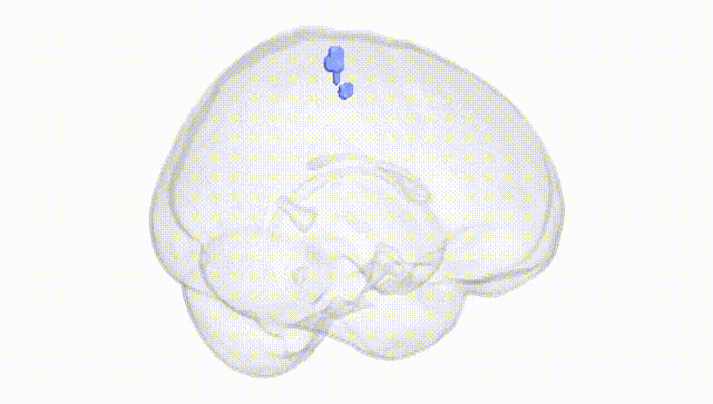 Full Brain White
