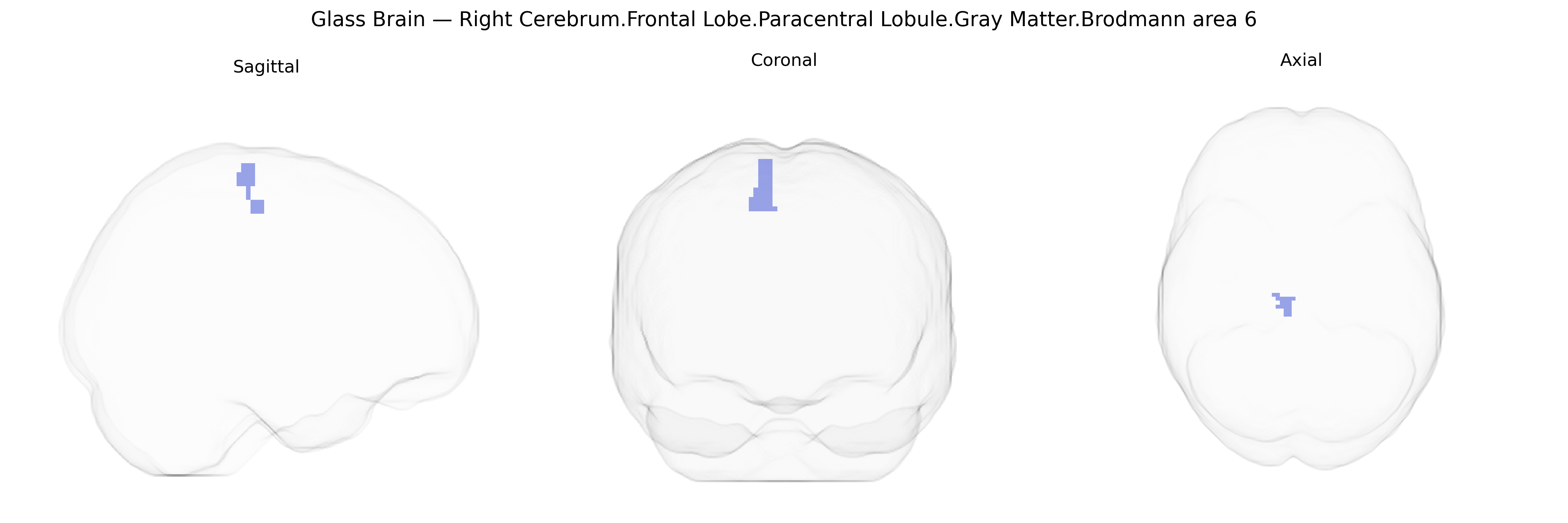 Triplanar Ghost Brain