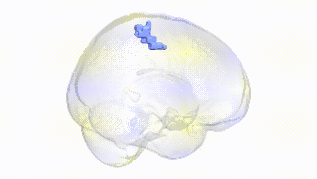 Full Brain White