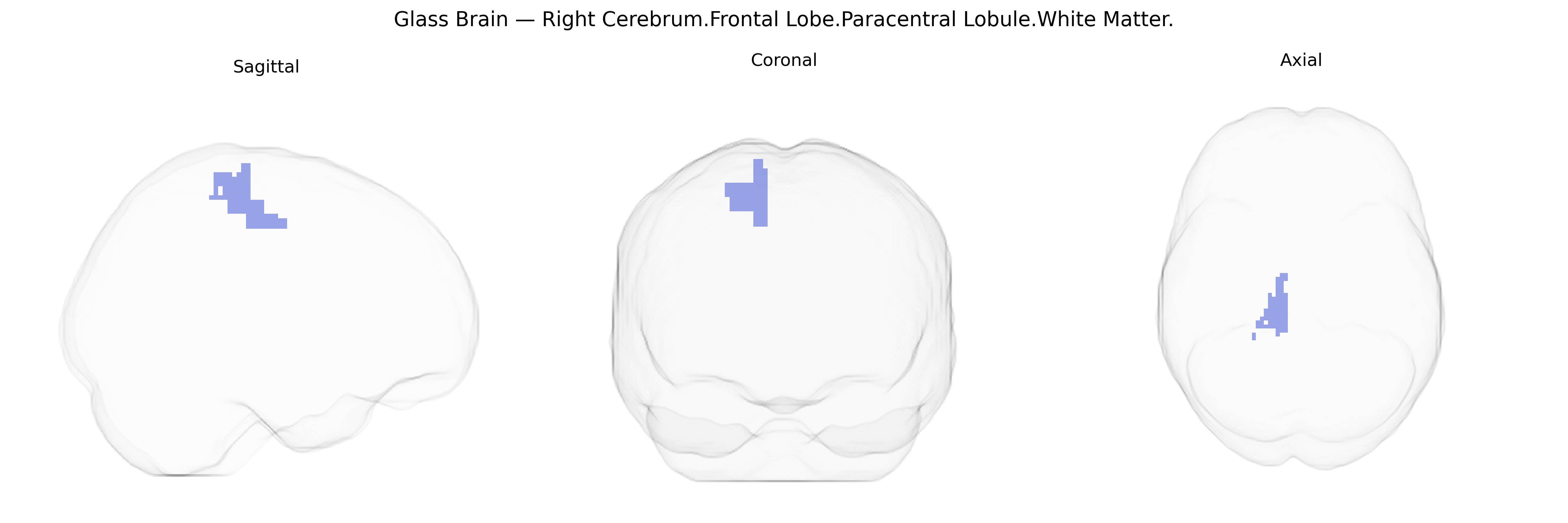 Triplanar Ghost Brain