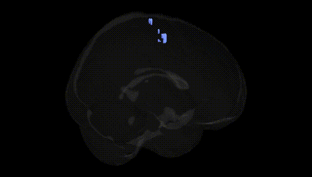 Full Brain Black
