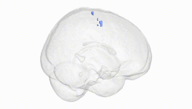 Full Brain White