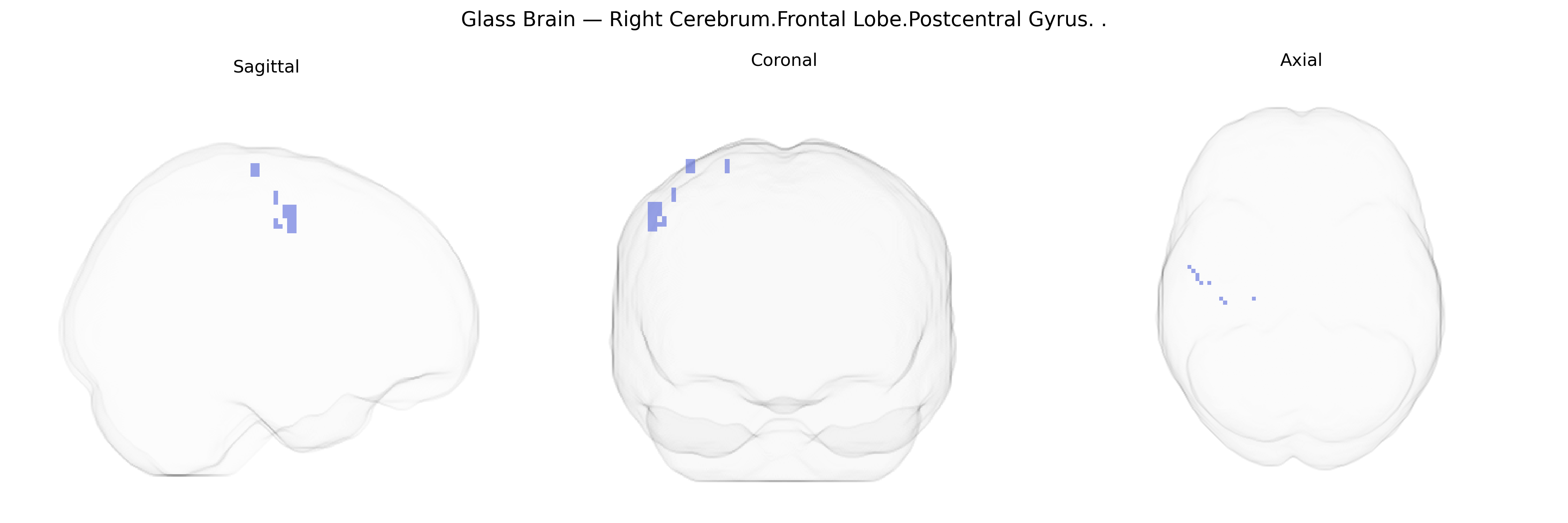 Triplanar Ghost Brain
