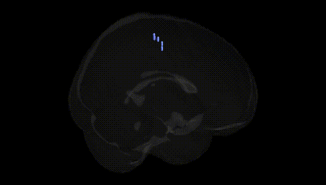 Full Brain Black