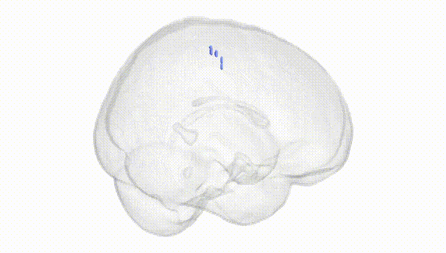 Full Brain White