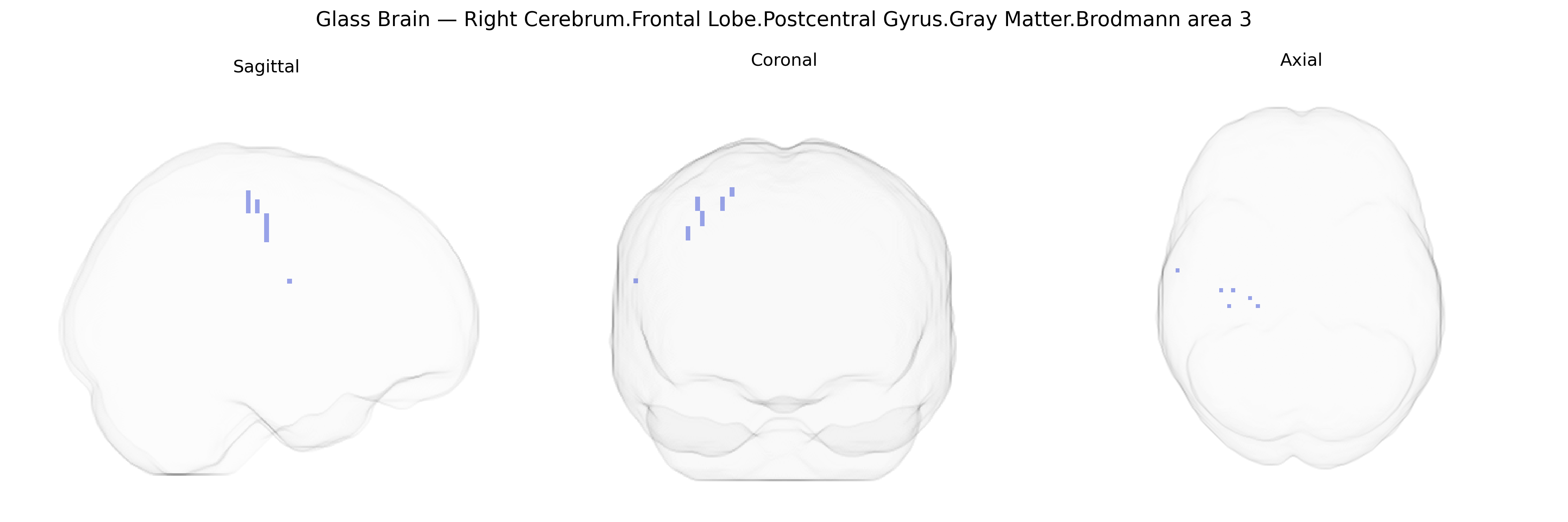 Triplanar Ghost Brain