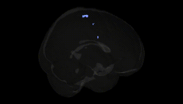 Full Brain Black
