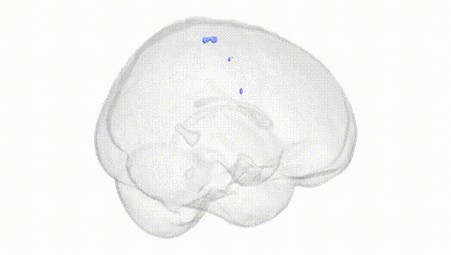Full Brain White