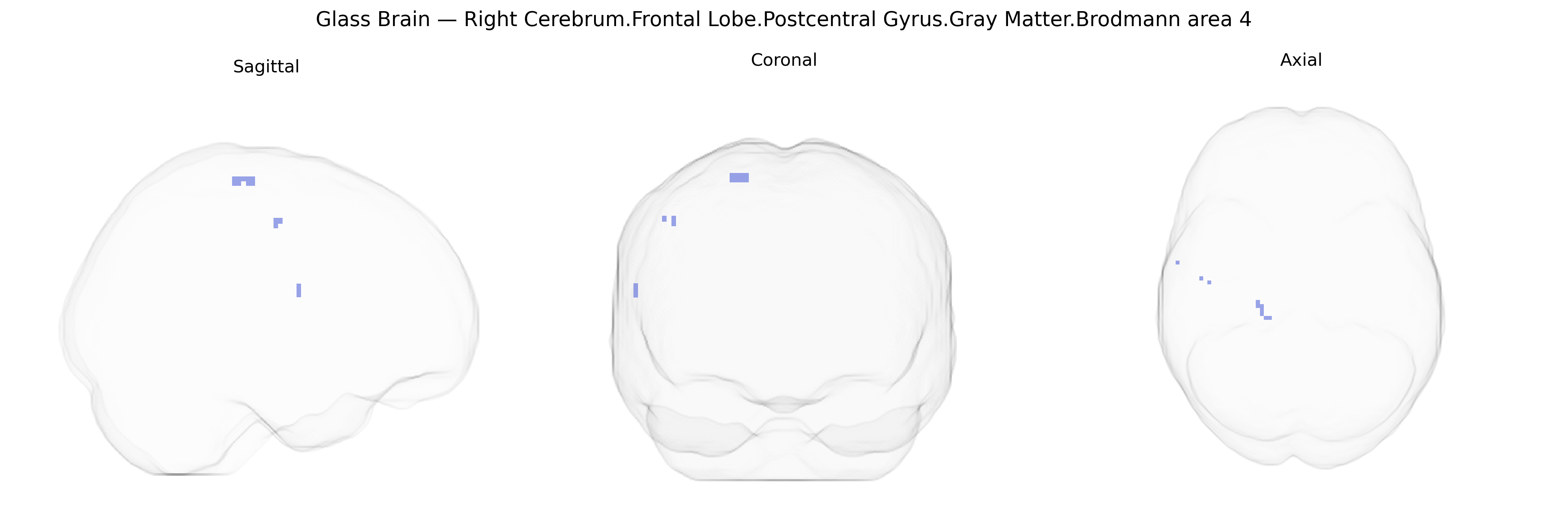 Triplanar Ghost Brain