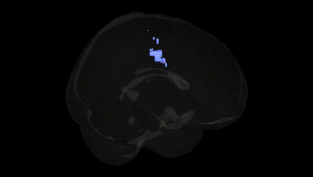 Full Brain Black