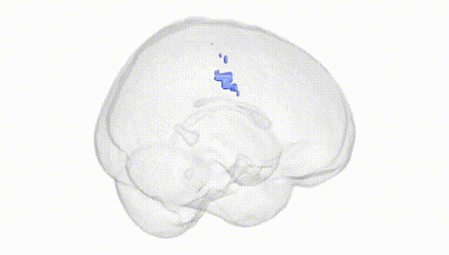 Full Brain White