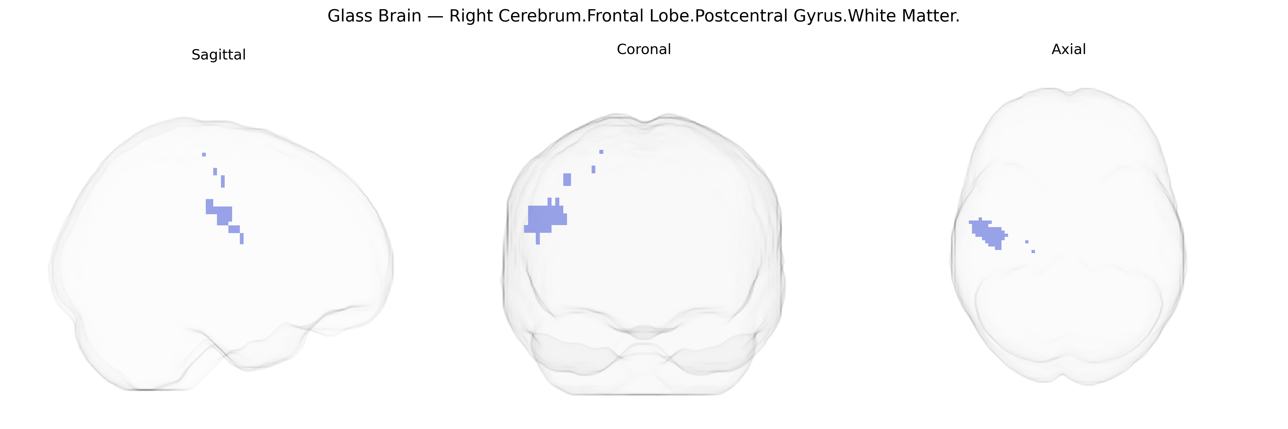Triplanar Ghost Brain