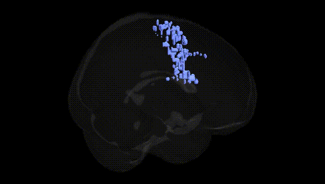Full Brain Black