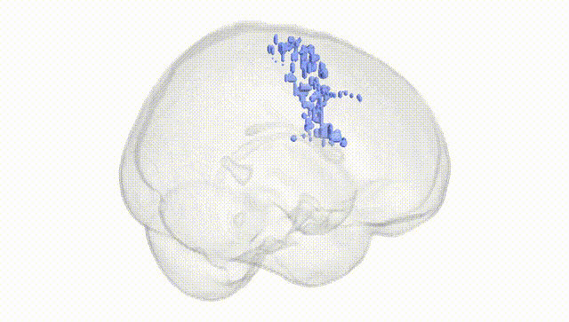 Full Brain White