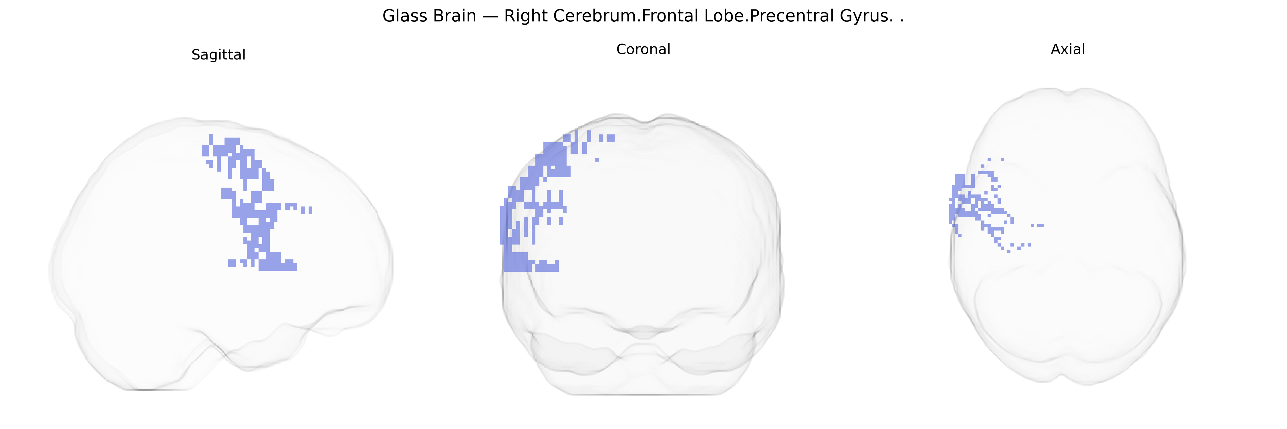 Triplanar Ghost Brain