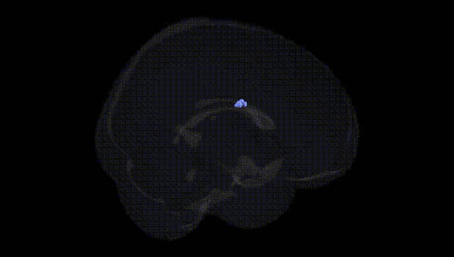 Full Brain Black