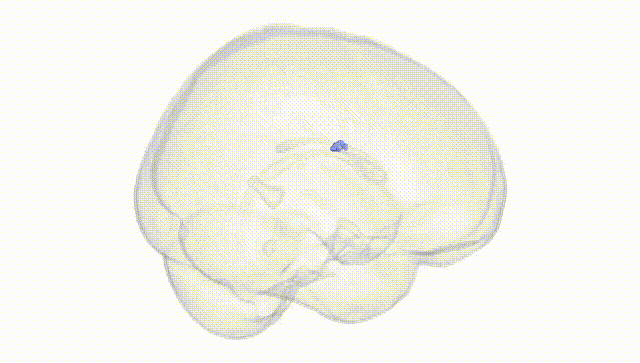 Full Brain White