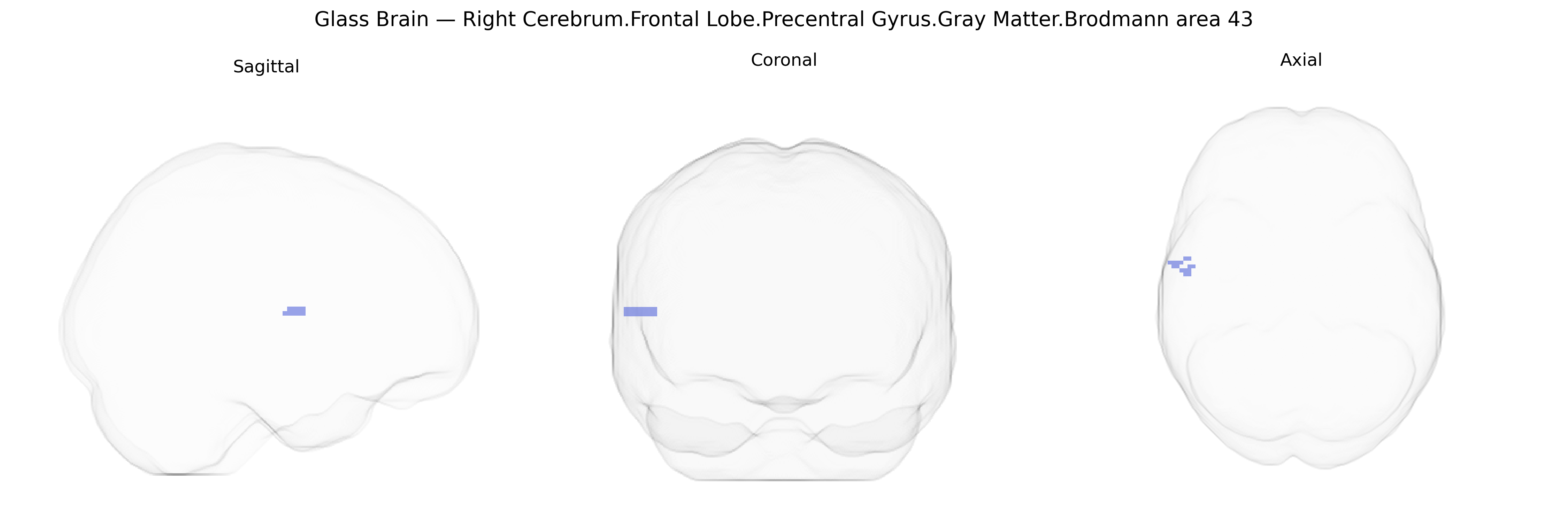 Triplanar Ghost Brain