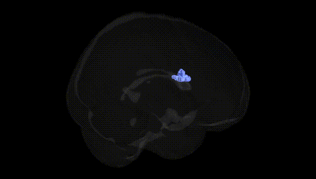 Full Brain Black