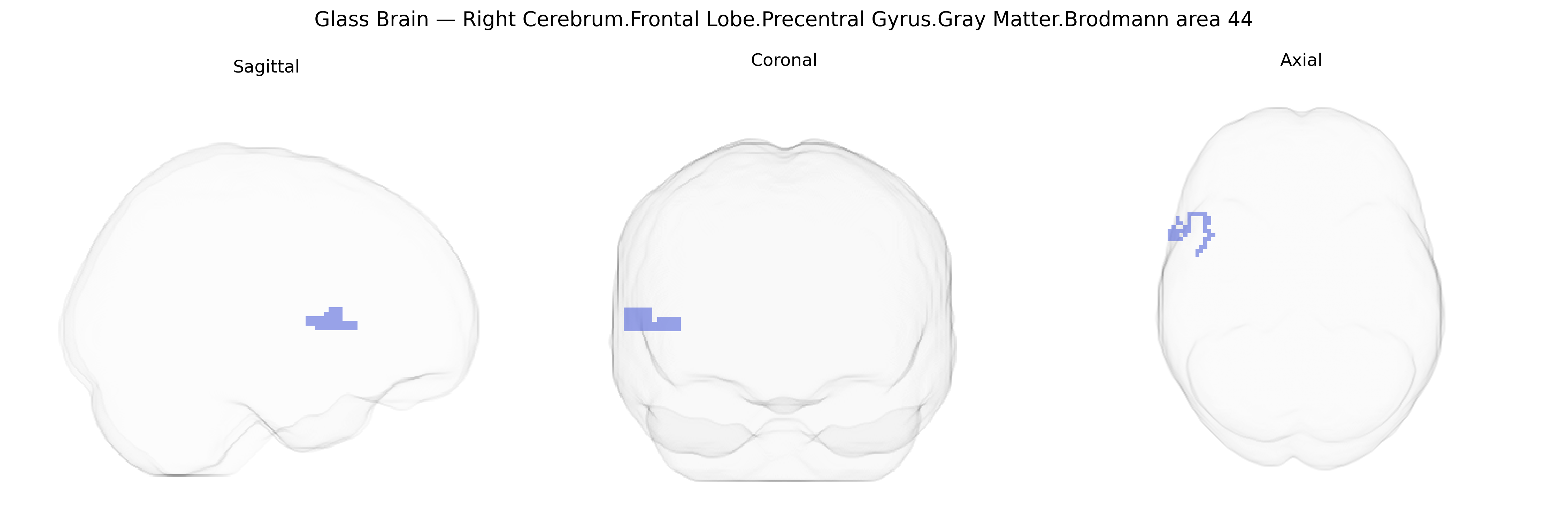 Triplanar Ghost Brain