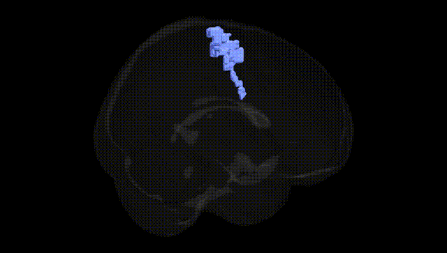 Full Brain Black
