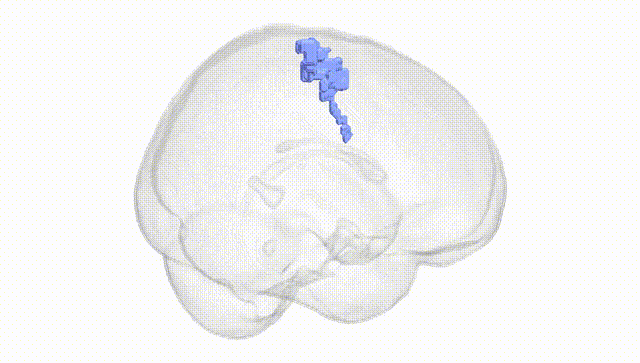 Full Brain White