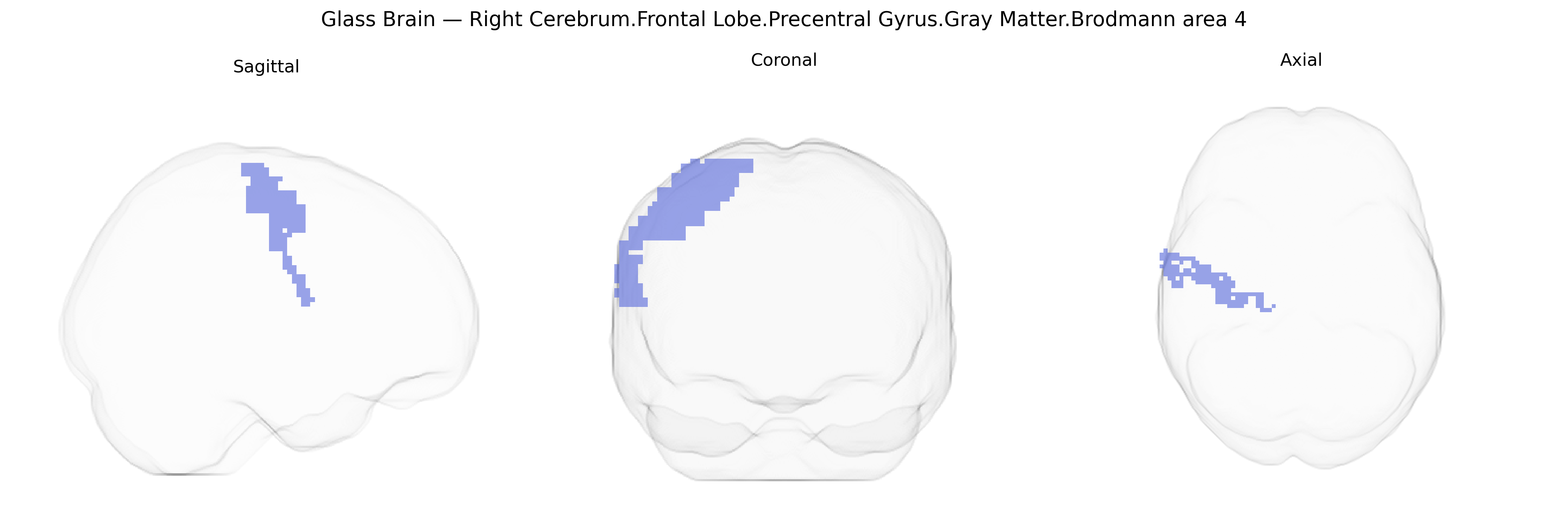 Triplanar Ghost Brain
