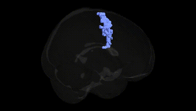Full Brain Black