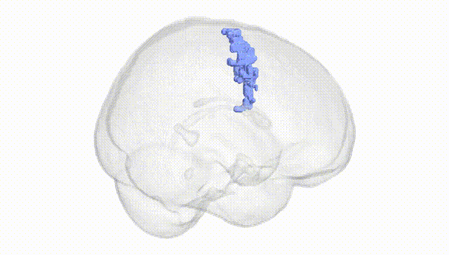 Full Brain White