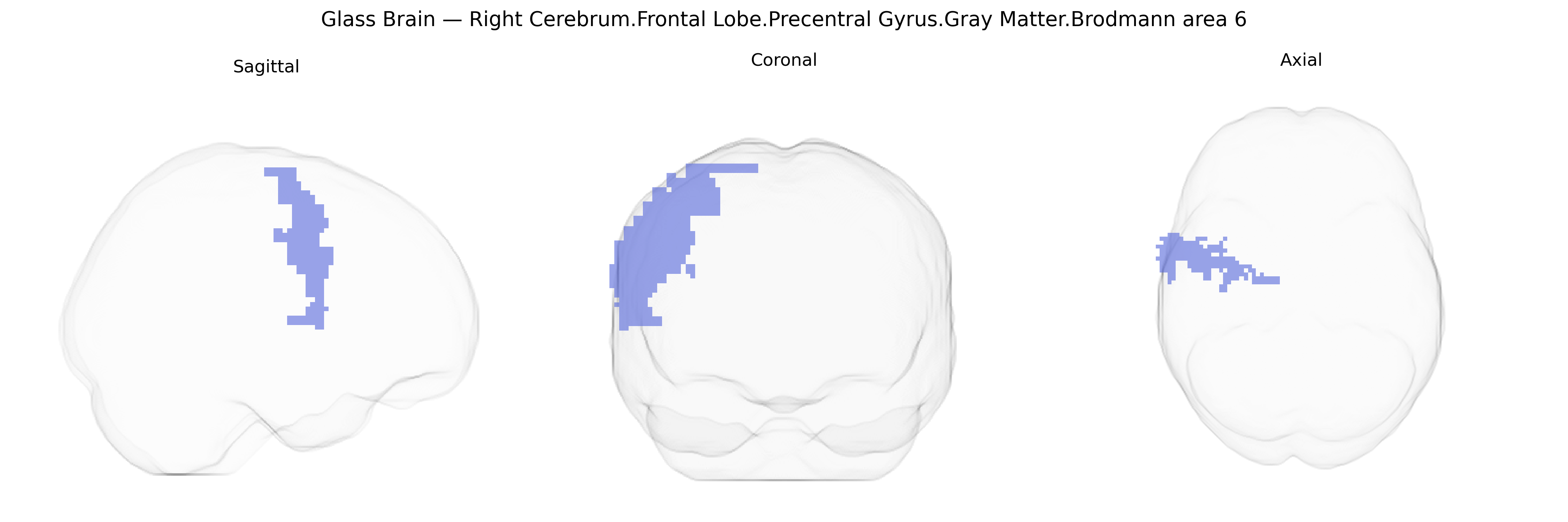 Triplanar Ghost Brain