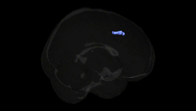 Full Brain Black